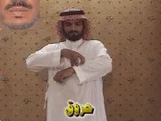 توضيح إشارة "حروق" - Sign demonstration for "burning"