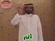 توضيح إشارة "ألم" - Sign demonstration for "pain"