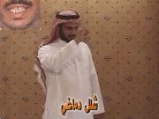 توضيح إشارة "شلل دماغي" - Sign demonstration for "cerebral paralysis"